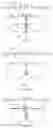 Fig. 14 - Left atrial appendage occluder for improving sealing effect and manufacturing method thereof