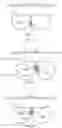 Fig. 17 - Left atrial appendage occluder for improving sealing effect and manufacturing method thereof