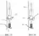 Fig. 12 - Bone drilling cover device
