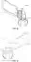 Fig. 09 - Tibial cut guide