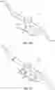 Fig. 15 - Tibial cut guide