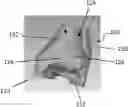 Fig. 01 - Patient-specific template for total ankle replacement
