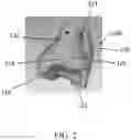 Fig. 03 - Patient-specific template for total ankle replacement