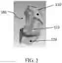 Fig. 04 - Patient-specific template for total ankle replacement