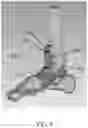 Fig. 06 - Patient-specific template for total ankle replacement