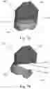 Fig. 08 - Patient-specific template for total ankle replacement