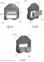 Fig. 10 - Patient-specific template for total ankle replacement