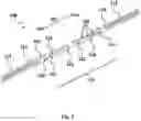 Fig. 03 - Devices for the removal of clots