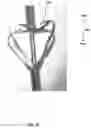 Fig. 08 - Devices for the removal of clots