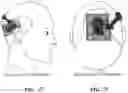 Fig. 40 - PIXEL ARRAY MEDICAL DEVICES AND METHODS