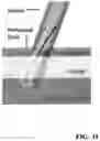 Fig. 43 - PIXEL ARRAY MEDICAL DEVICES AND METHODS
