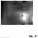 Fig. 49 - PIXEL ARRAY MEDICAL DEVICES AND METHODS