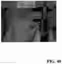 Fig. 52 - PIXEL ARRAY MEDICAL DEVICES AND METHODS
