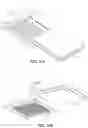 Fig. 30 - Pixel array medical systems, devices and methods