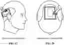 Fig. 37 - Pixel array medical systems, devices and methods