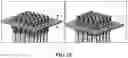 Fig. 55 - Pixel array medical systems, devices and methods