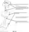 Fig. 61 - Pixel array medical systems, devices and methods
