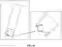 Fig. 68 - Pixel array medical systems, devices and methods