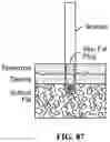 Fig. 87 - Pixel array medical systems, devices and methods