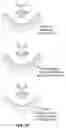 Fig. 93 - Pixel array medical systems, devices and methods
