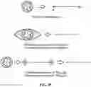 Fig. 95 - Pixel array medical systems, devices and methods