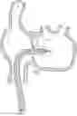 Fig. 01 - Steerable endoluminal punch