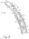 Fig. 06 - Steerable endoluminal punch