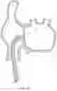 Fig. 15 - Steerable endoluminal punch