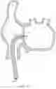 Fig. 16 - Steerable endoluminal punch