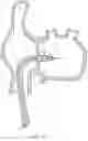Fig. 17 - Steerable endoluminal punch
