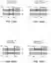 Fig. 115 - Switch arrangements for ultrasonic surgical instruments