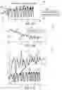 Fig. 31 - Switch arrangements for ultrasonic surgical instruments