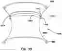 Fig. 09 - Multifunctional surgical access system