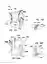 Fig. 10 - Multifunctional surgical access system