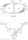 Fig. 10 - Method of securing perianal support device