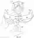 Fig. 13 - Method of securing perianal support device
