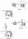 Fig. 07 - Spinal correction system and method of use thereof