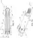 Fig. 03 - Stabilization system, implant, and methods for preventing relative motion between sections of tissue