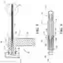 Fig. 06 - Stabilization system, implant, and methods for preventing relative motion between sections of tissue