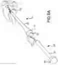 Fig. 07 - Vertebral joint implants and delivery tools