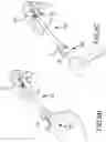 Fig. 08 - Vertebral joint implants and delivery tools