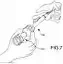 Fig. 09 - Vertebral joint implants and delivery tools