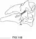 Fig. 131 - Vertebral joint implants and delivery tools