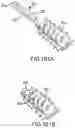 Fig. 134 - Vertebral joint implants and delivery tools