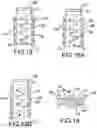 Fig. 15 - Vertebral joint implants and delivery tools