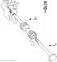 Fig. 20 - Vertebral joint implants and delivery tools
