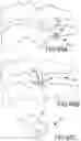 Fig. 56 - Vertebral joint implants and delivery tools