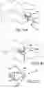 Fig. 62 - Vertebral joint implants and delivery tools