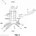 Fig. 04 - Adjustable rib and sternal implant