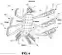 Fig. 05 - Adjustable rib and sternal implant